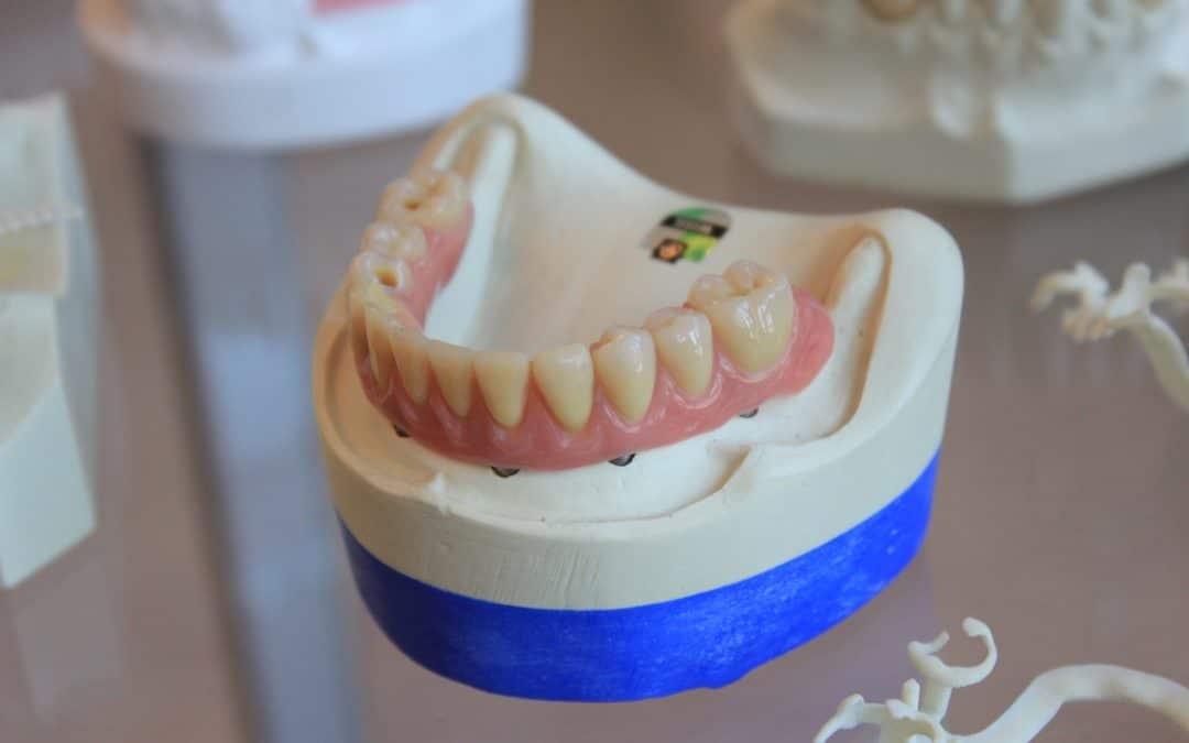 5 Ways to Damage Your Dentures