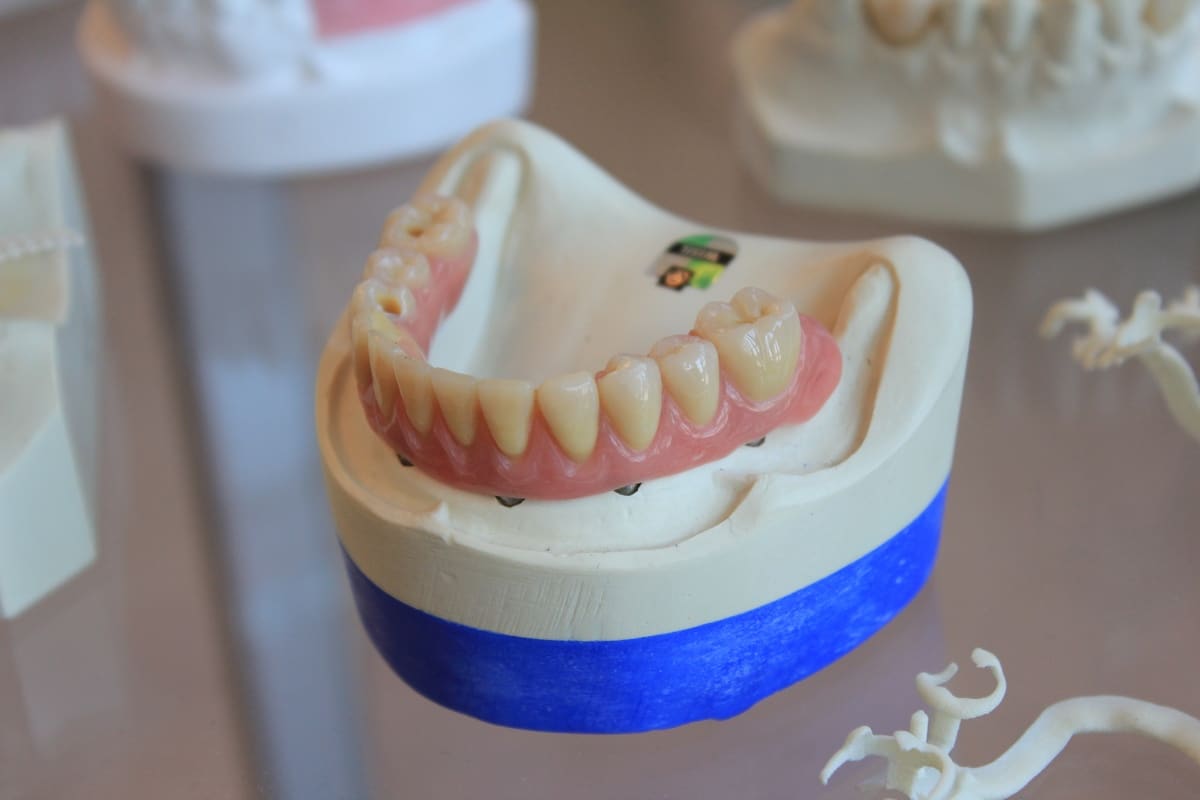 5 Ways to Damage Your Dentures
