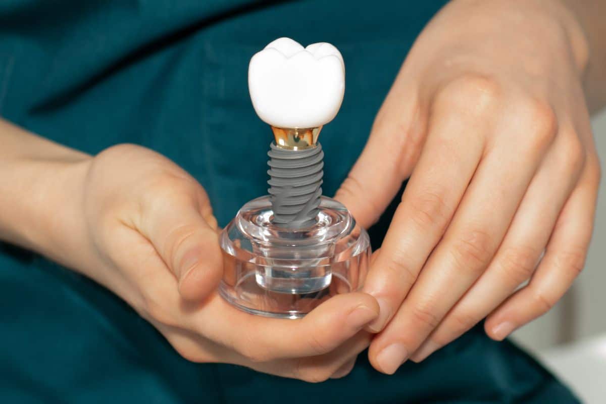Dental implant component